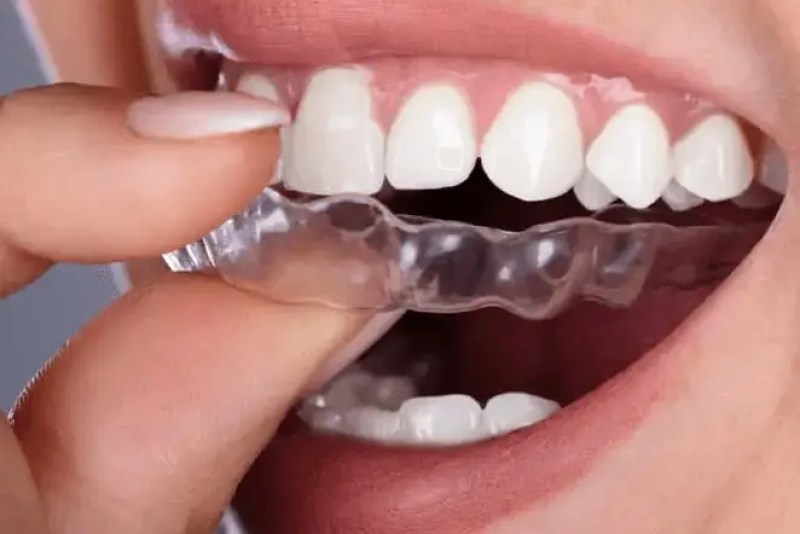 Dentist near me, dentista cerca de mi, best dentist miami, mejor dentista miami, pizza near me, chinese near me, food near me, crown dentist miami, cheapest dentist miami, root canal dentist miami, cheapest root canal miami