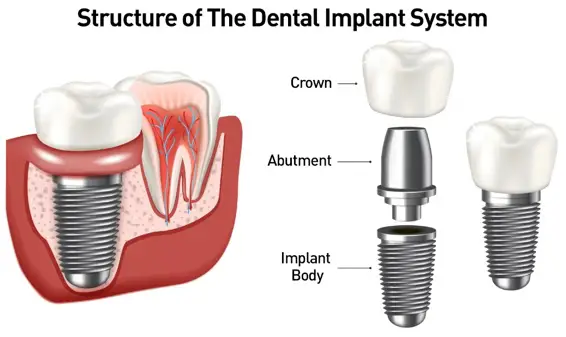 Atención dental en Dr. G Dental Studio, Miami